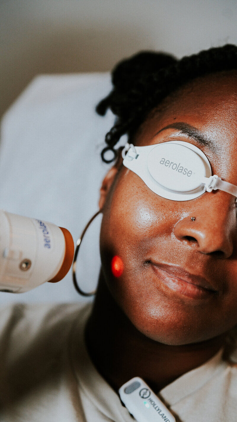Aerolase Laser