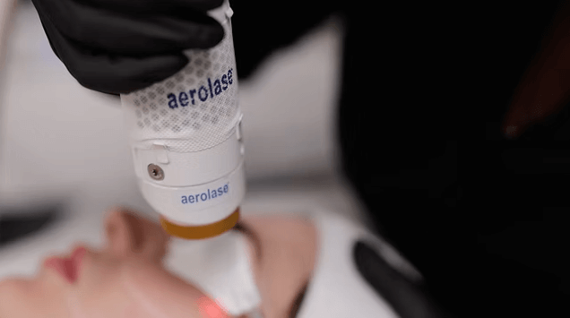 aerolase neo elite