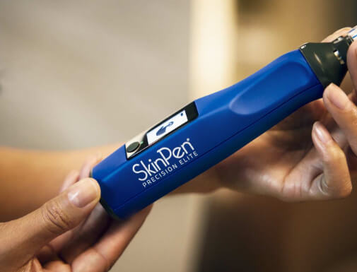 skin pen
