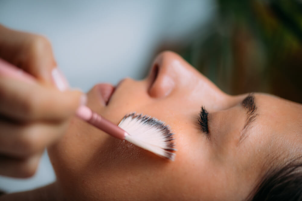 Chemical Peels in Lanham, MD - Treatment