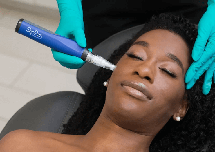 SkinPen Microneedling img